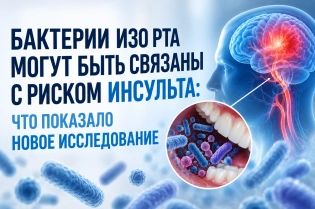 Бактерии изо рта могут быть связаны с риском инсульта: что показало новое исследование